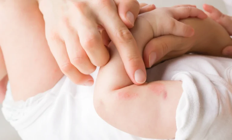 Understanding Baby Skin Types