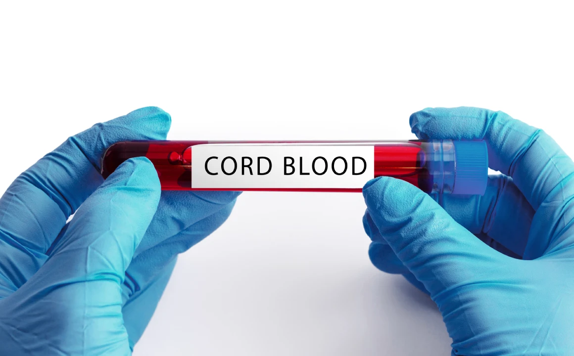 Umbilical Cord Blood Stem Cells